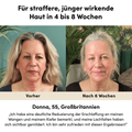 RegenMask | Klinik-Lift für zu Hause